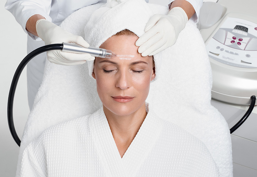 Microdermabrasion an der Stirn einer Kundin